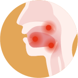 Mondproblemen en slikstoornissen in de palliatieve fase Pijn in de mond